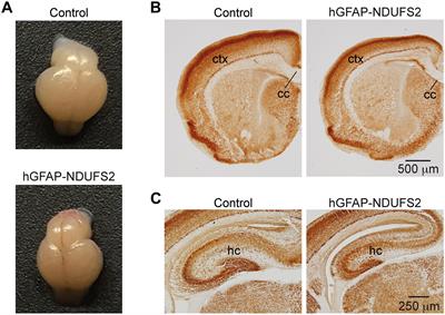 Mitochondrial Complex I Function Is Essential for Neural Stem/Progenitor Cells Proliferation and Differentiation